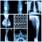 Radiography of Human Bones: X-rays and MRI scans of legs, lungs, arm, sinus,knees, had